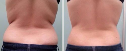 tightsculpting1