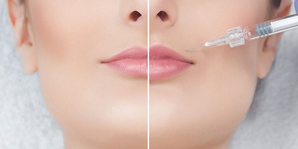 New-Leaf-Spa-Laser-Services-Injectables-Fillers-How-They-Work-Dermal-Fillers-1-600x400 New-Leaf-Spa-Laser-Services-Injectables-Fillers-How-They-Work-Dermal-Fillers-1-600x400