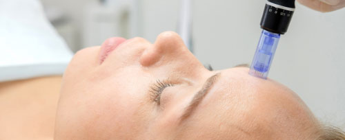 New-Leaf-Spa-Laser-Remedy-Winter-Skin-Blues-Types-Facials-Microneedling-Blog-500x204