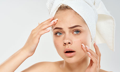 New-Leaf-Spa-Laser-Acne-Treatments-1-500x300