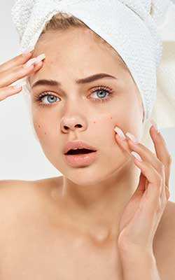 New-Leaf-Spa-Laser-How-Facials-Support-Acne-Treatments-1-250x400