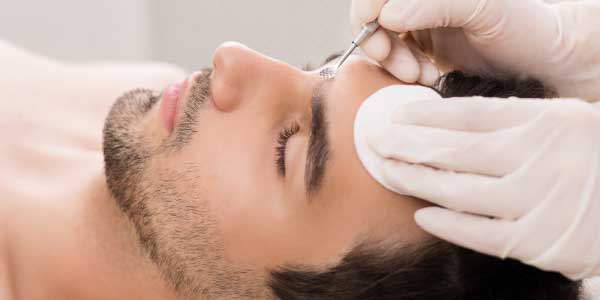 New-Leaf-Spa-Laser-How-Facials-Support-Acne-Treatments-Blemish-Removal-600x300