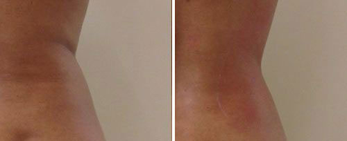 tightsculpting3