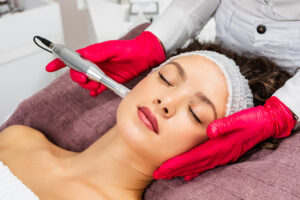 Prepare for Your Microneedling Treatment with These Tips